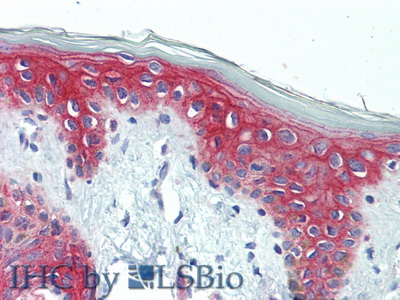 Polyclonal Antibody to Desmoplakin (DSP)