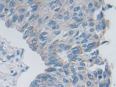 Polyclonal Antibody to Desmoplakin (DSP)