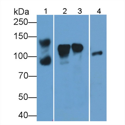 Polyclonal Antibody to Amphiphysin (AMPH)