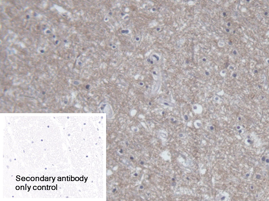 Polyclonal Antibody to Amphiphysin (AMPH)