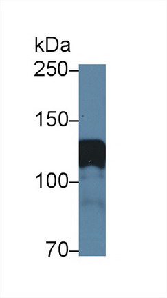 Polyclonal Antibody to Amphiphysin (AMPH)