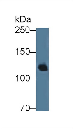 Polyclonal Antibody to Amphiphysin (AMPH)