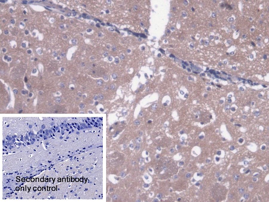 Polyclonal Antibody to Amphiphysin (AMPH)