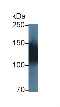 Polyclonal Antibody to Amphiphysin (AMPH)