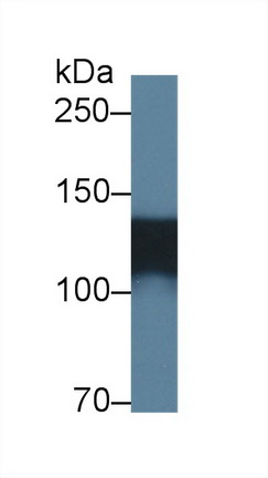 Polyclonal Antibody to Amphiphysin (AMPH)