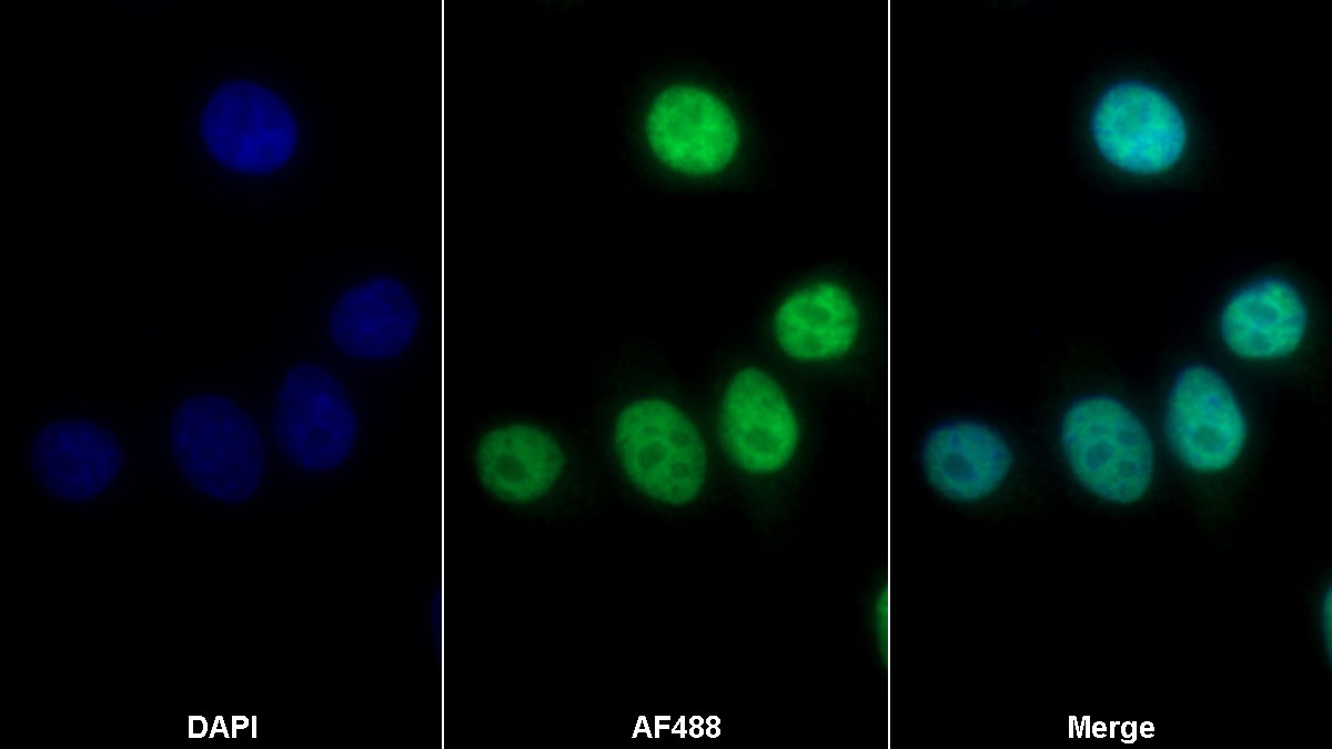 Polyclonal Antibody to Histone Deacetylase 2 (HDAC2)