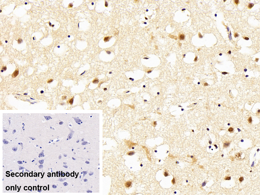 Polyclonal Antibody to Histone Deacetylase 2 (HDAC2)