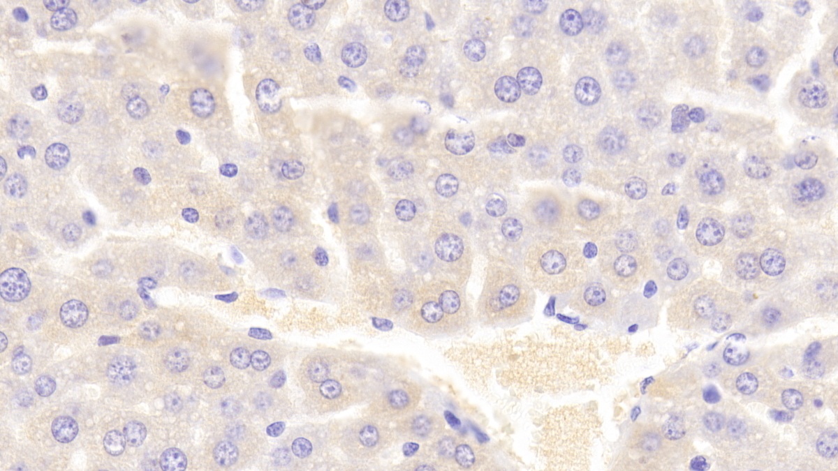 Polyclonal Antibody to Vav 1 Oncogene (VAV1)