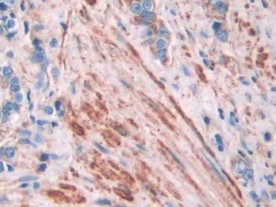 Polyclonal Antibody to Filamin A Alpha (FLNa)