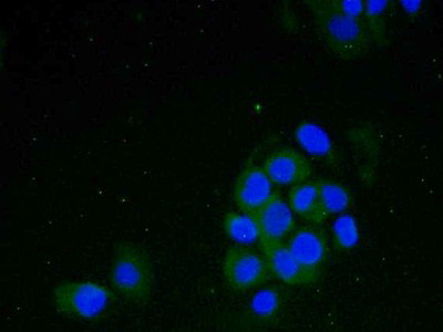 Polyclonal Antibody to Filamin A Alpha (FLNa)