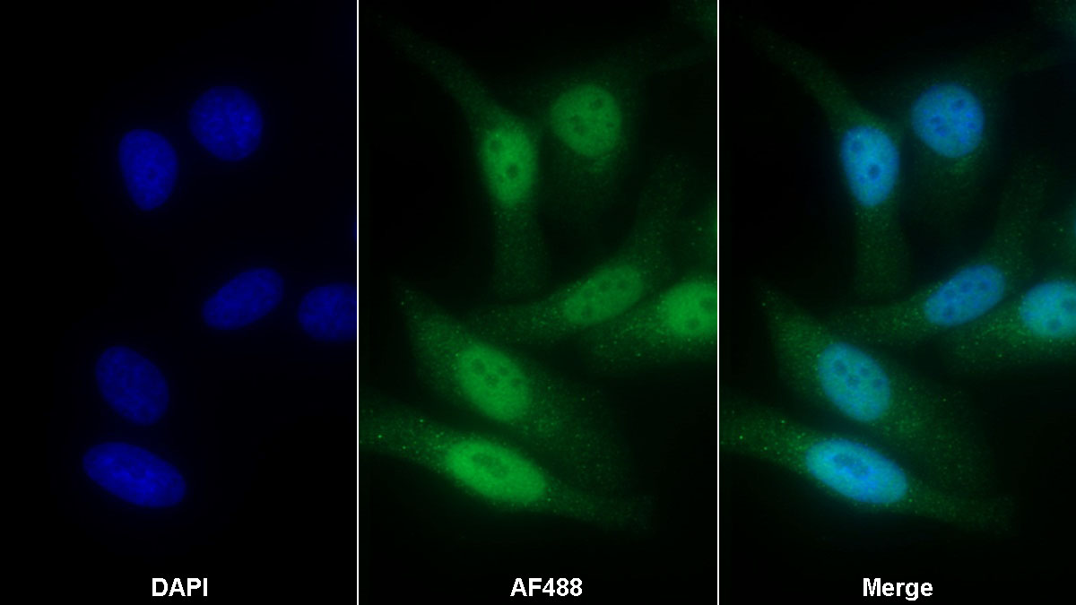 Polyclonal Antibody to E1A Binding Protein P300 (EP300)