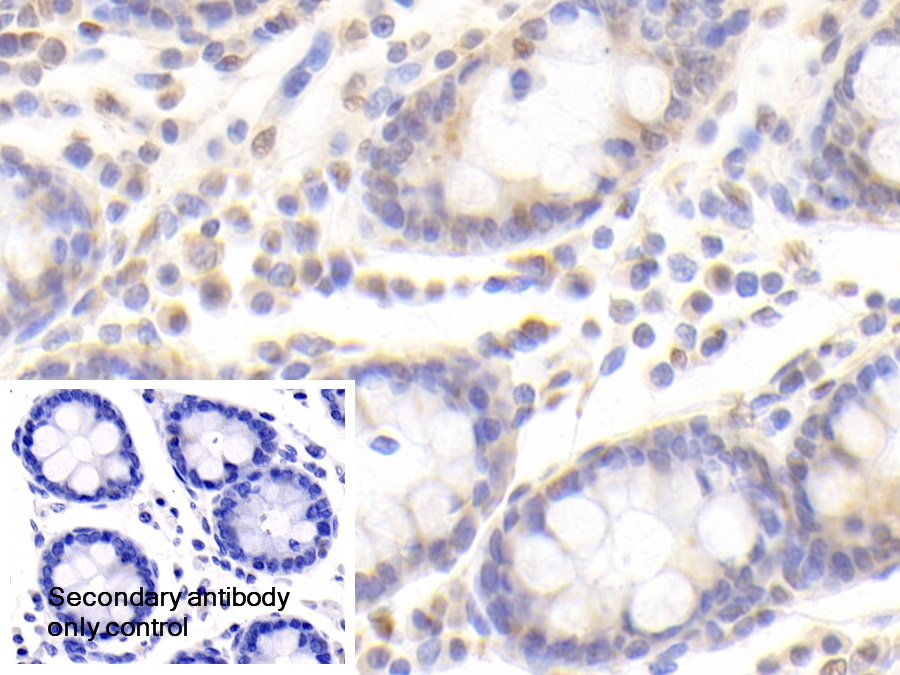 Polyclonal Antibody to Amyloid Beta Precursor Protein Binding Protein 1 (APPBP1)