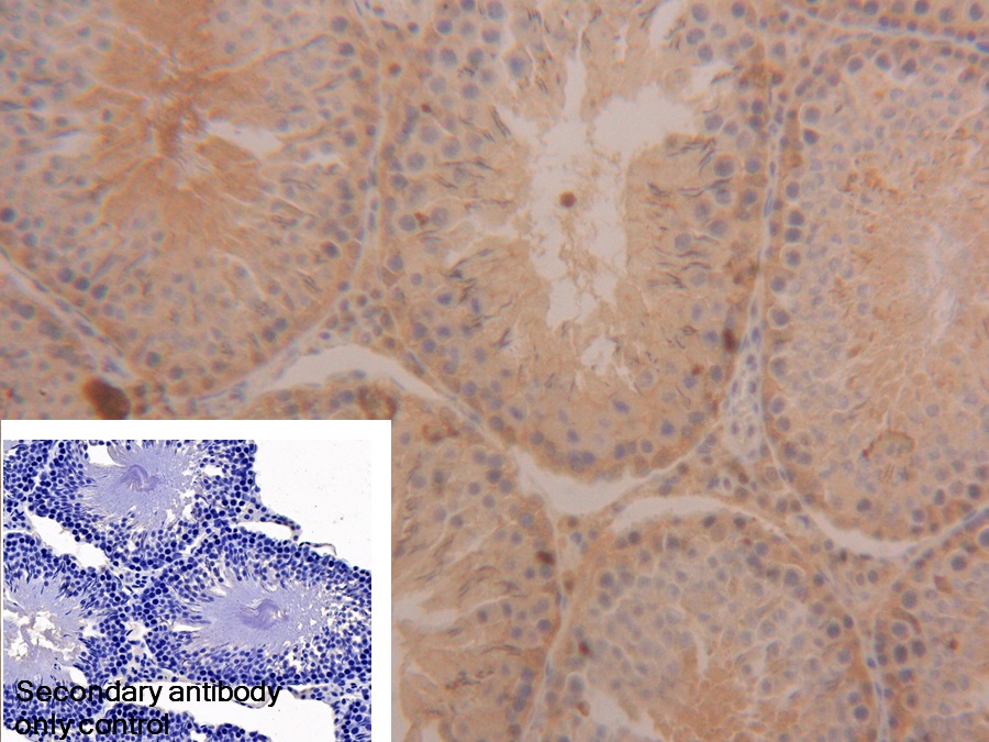 Polyclonal Antibody to Bleomycin Hydrolase (BLMH)