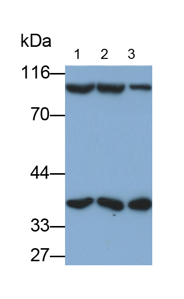 Polyclonal Antibody to Promyelocytic Leukemia Protein (PML)