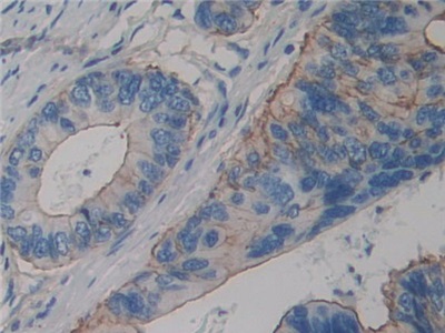 Polyclonal Antibody to Actinin Alpha 4 (ACTN4)