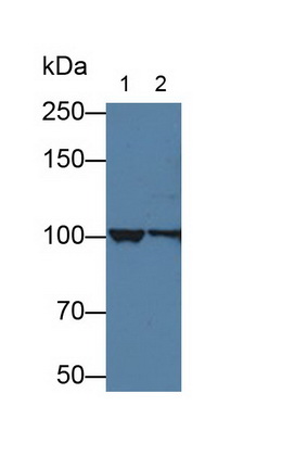 Polyclonal Antibody to Actinin Alpha 4 (ACTN4)