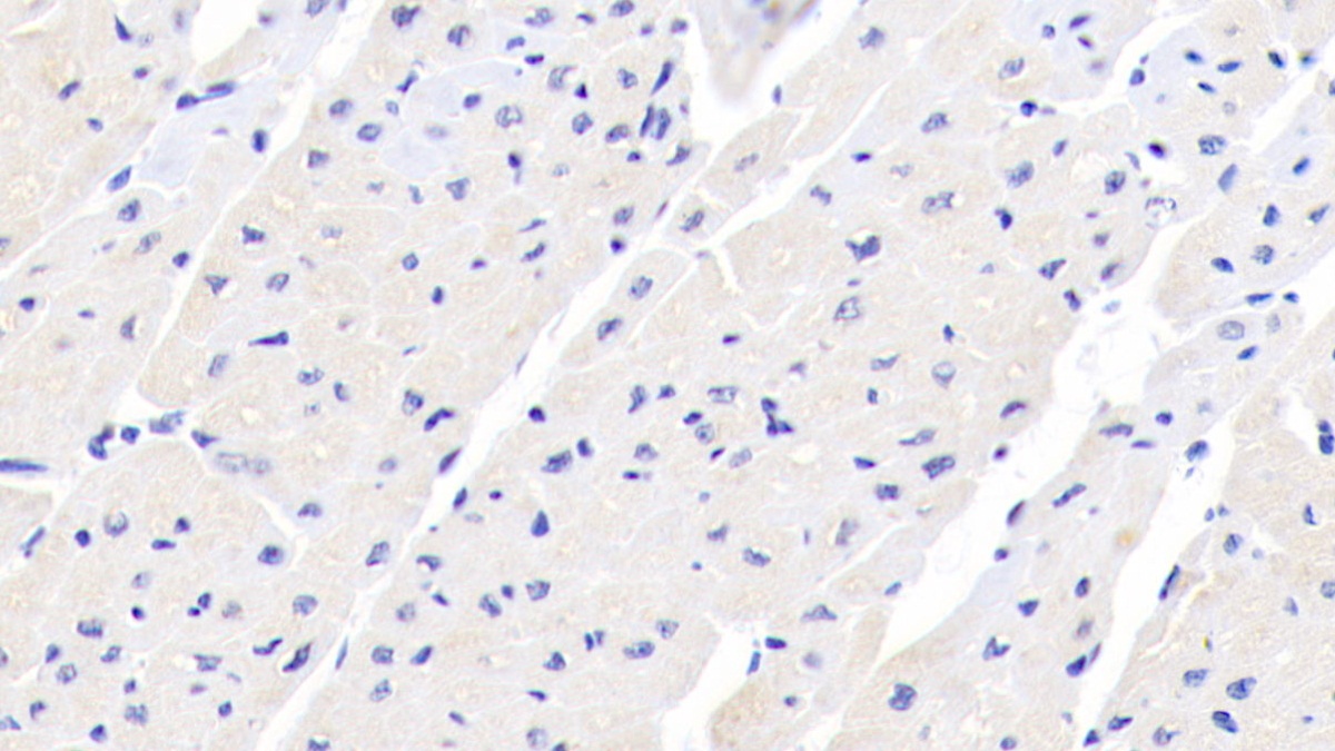 Polyclonal Antibody to Tripartite Motif Containing Protein 3 (TRIM3)