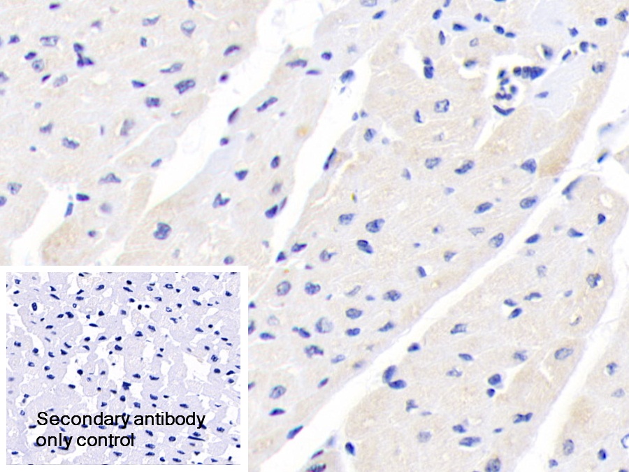 Polyclonal Antibody to Tripartite Motif Containing Protein 3 (TRIM3)