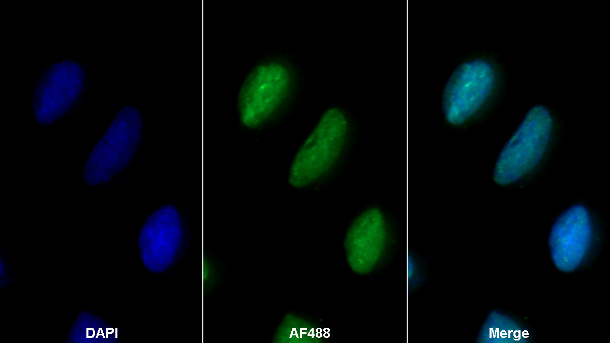 Polyclonal Antibody to Atrophin 1 (ATN1)