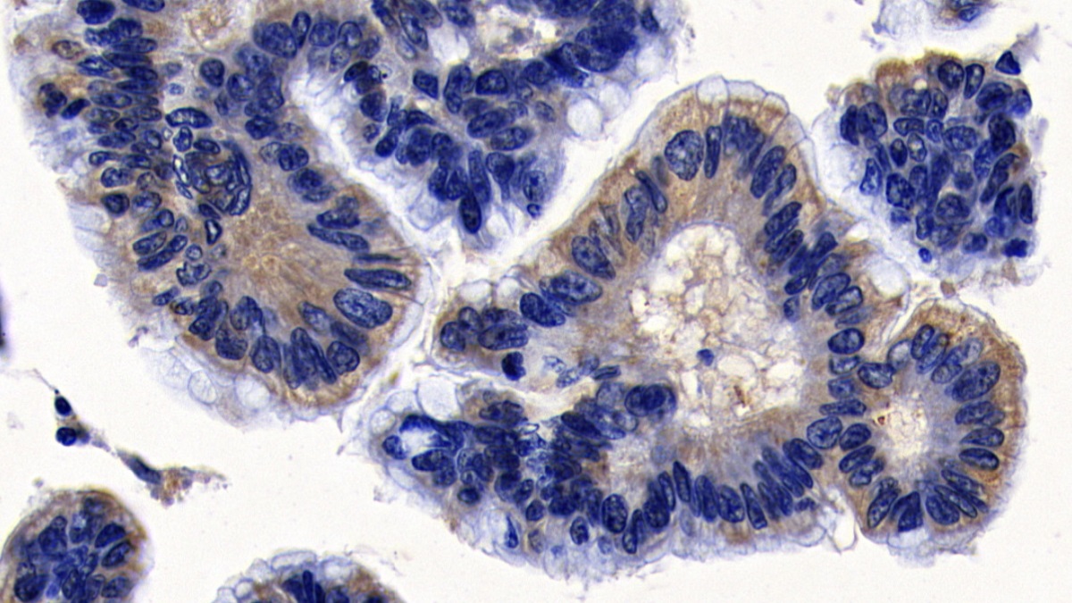 Polyclonal Antibody to Protein Tyrosine Phosphatase, Non Receptor Type 1 (PTPN1)