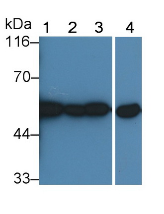 Polyclonal Antibody to Protein Kinase B Alpha (PKBa)