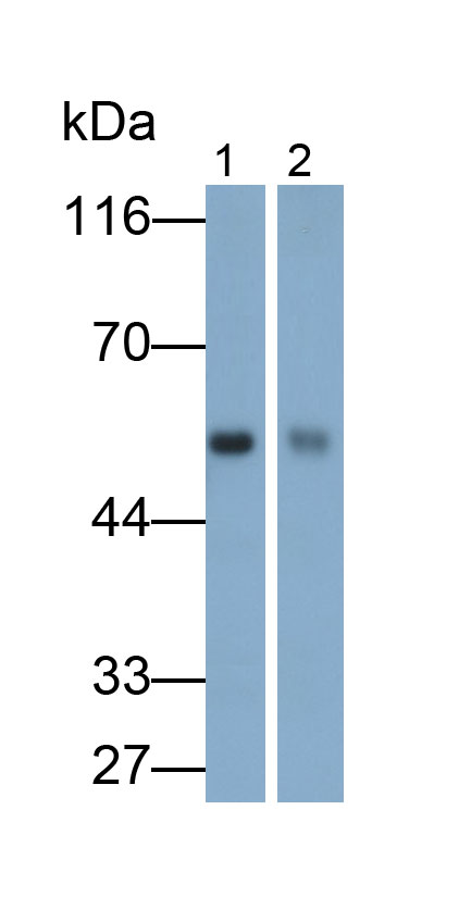 Polyclonal Antibody to Protein Kinase B Alpha (PKBa)