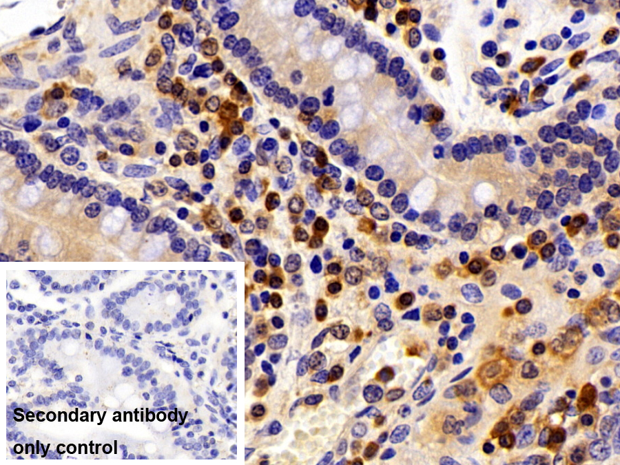 Polyclonal Antibody to Profilin 1 (PFN1)