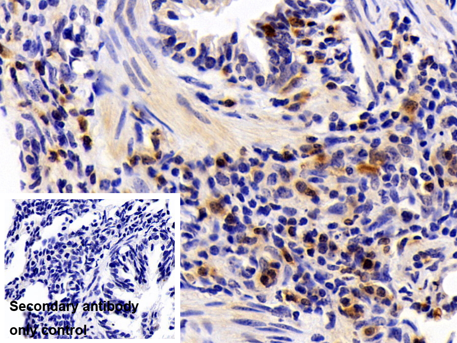 Polyclonal Antibody to Profilin 1 (PFN1)