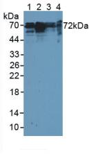 Polyclonal Antibody to Cortactin (CTTN)