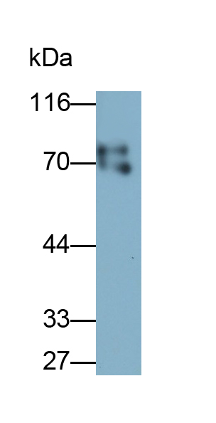 Polyclonal Antibody to Cortactin (CTTN)