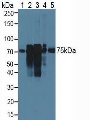 Polyclonal Antibody to Cortactin (CTTN)