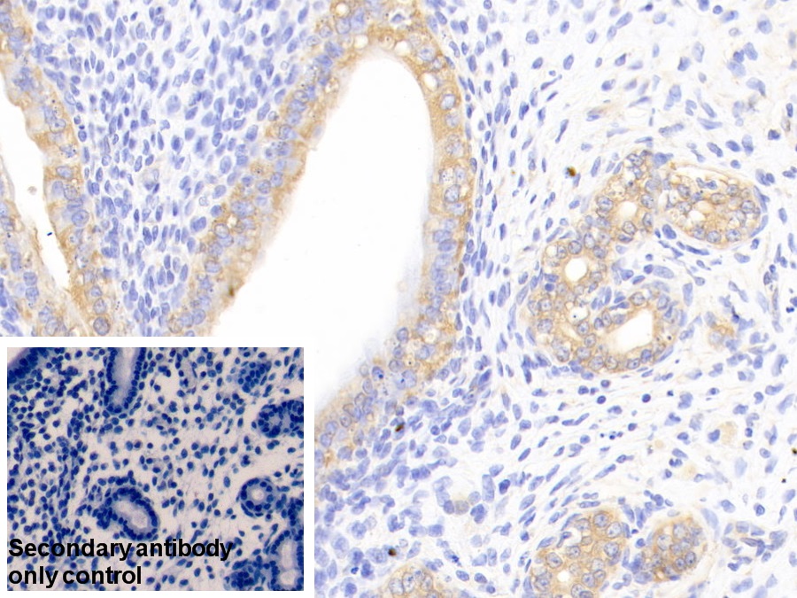 Polyclonal Antibody to Cortactin (CTTN)