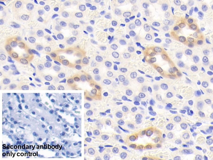 Polyclonal Antibody to Cortactin (CTTN)