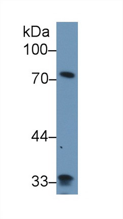 Polyclonal Antibody to Zyxin (ZYX)