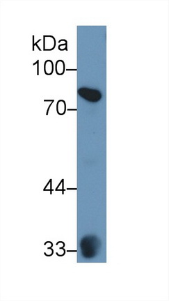 Polyclonal Antibody to Zyxin (ZYX)