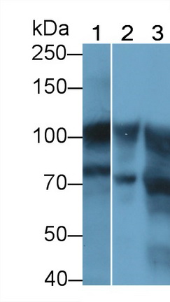 Polyclonal Antibody to Actinin Alpha 1 (ACTN1)