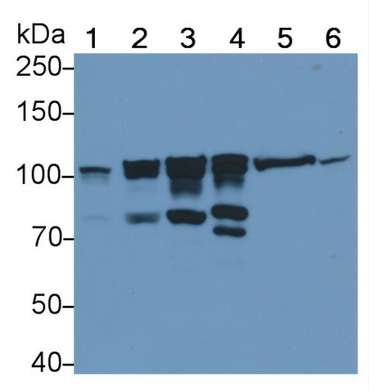 Polyclonal Antibody to Actinin Alpha 1 (ACTN1)