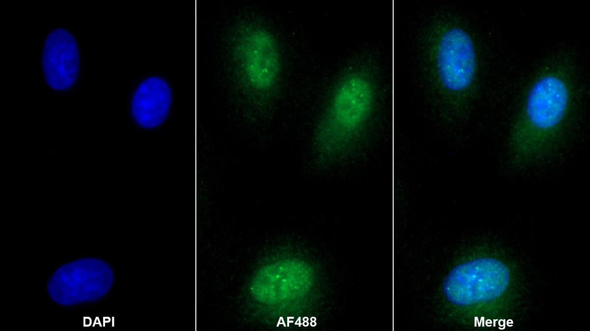 Polyclonal Antibody to Mediator Complex Subunit 1 (MED1)