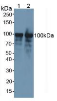 Polyclonal Antibody to Nucleolin (NCL)