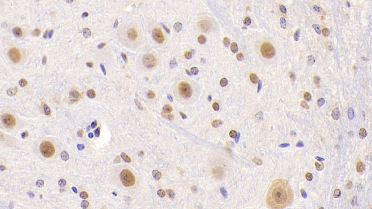 Polyclonal Antibody to Nucleolin (NCL)