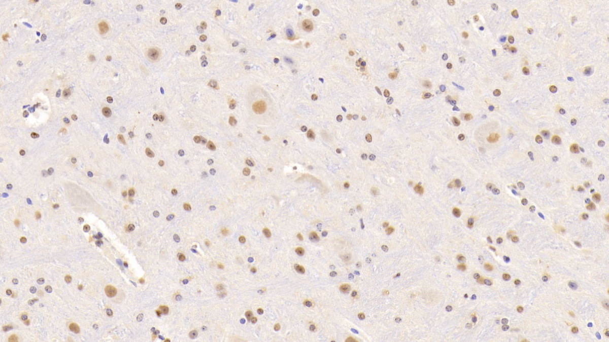 Polyclonal Antibody to Nucleolin (NCL)