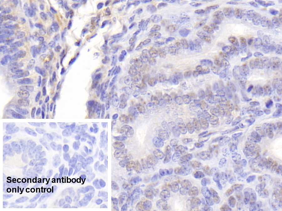 Polyclonal Antibody to Nucleolin (NCL)