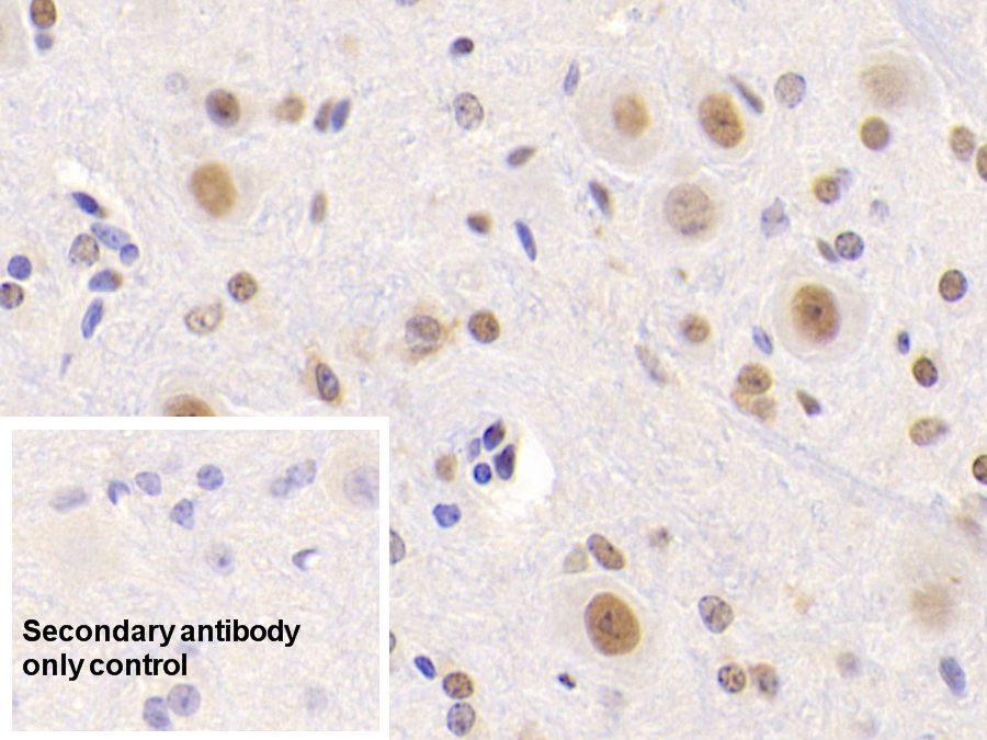 Polyclonal Antibody to Nucleolin (NCL)