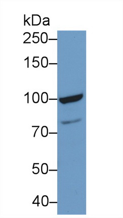 Polyclonal Antibody to Topoisomerase I (TOP1)