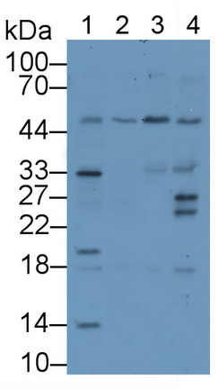 Polyclonal Antibody to Wilms Tumor 1 Associated Protein (WTAP)