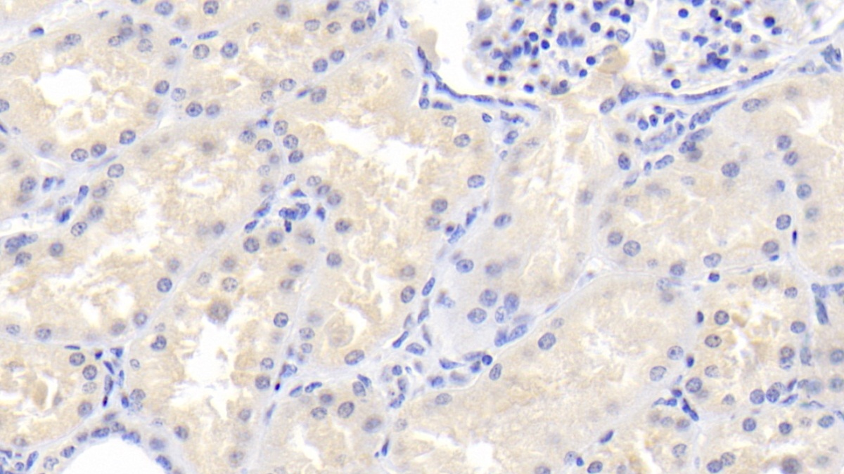 Polyclonal Antibody to Phosphoinositide Dependent Protein Kinase 1 (PDPK1)