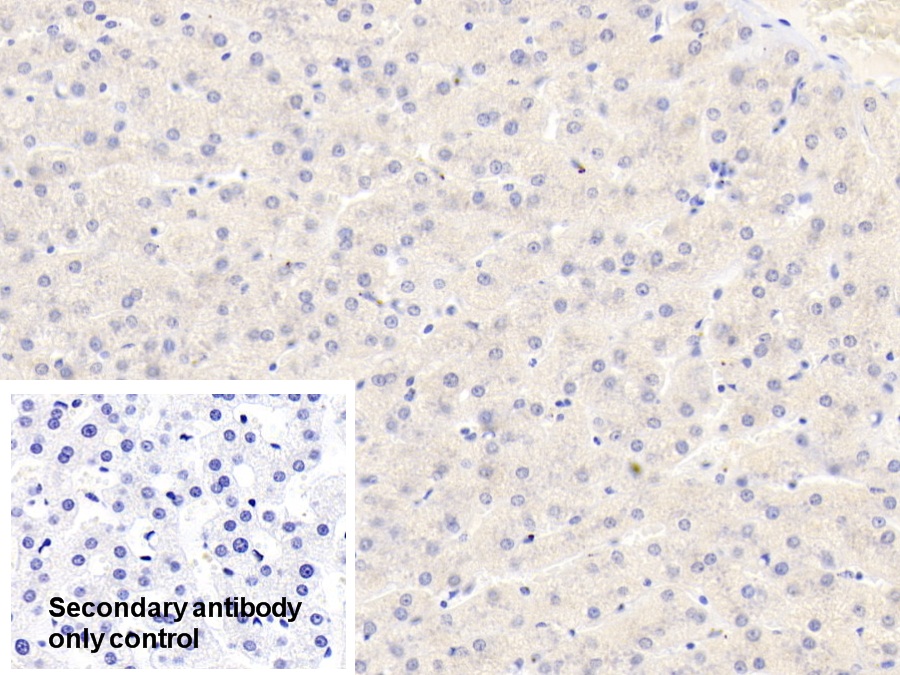 Polyclonal Antibody to Phosphoinositide Dependent Protein Kinase 1 (PDPK1)