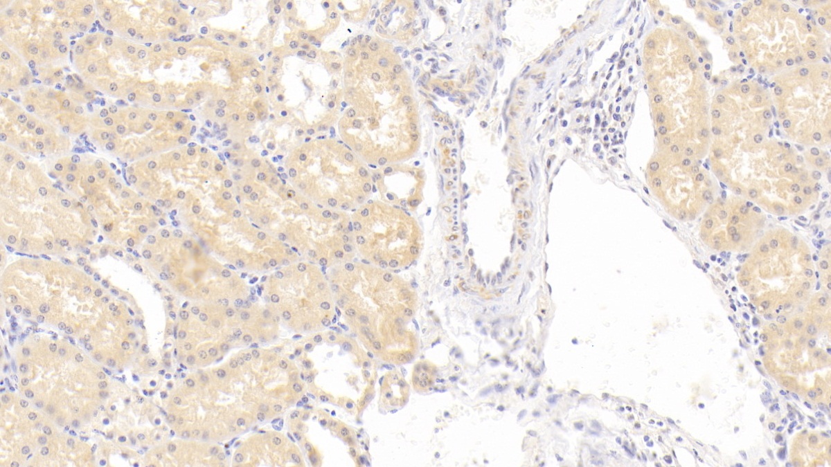 Polyclonal Antibody to Deoxyribonuclease II (DNASEII)