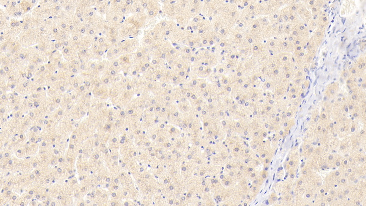 Polyclonal Antibody to Deoxyribonuclease II (DNASEII)