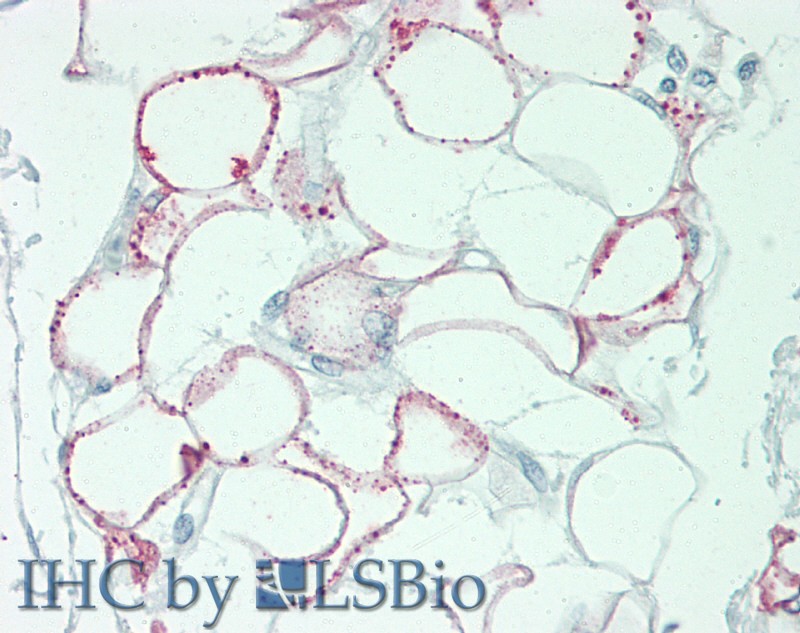 Polyclonal Antibody to Deoxyribonuclease II (DNASEII)